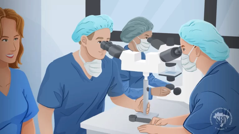 SBD – Cirurgia Micrográfica de Mohs